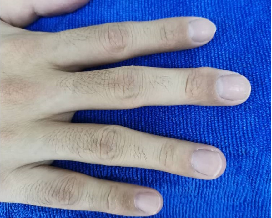 排毒后